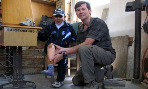 Prosthetic Clinic for Low-Income Bolivians Prosthetic Clinic for Low-Income Bolivians
